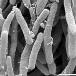 باکتری Xylella fastidiousa